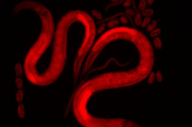 Bern Forschungsgruppe zeigt, wie mütterliche Nahrung Ribosomen leert